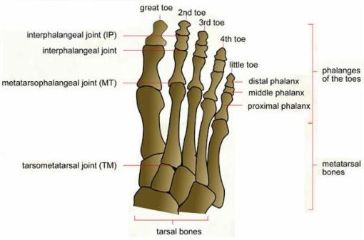 Help troubleshoot foot pain